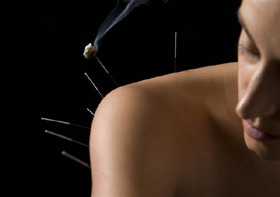 Acupunture needle inserted in the neck
