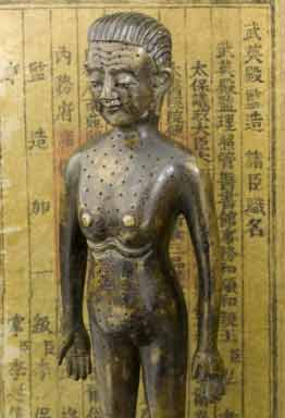 Chinese Acupuncture Statue
